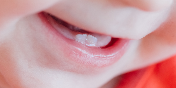 ¿Cuándo empezar la higiene dental de tu bebé?